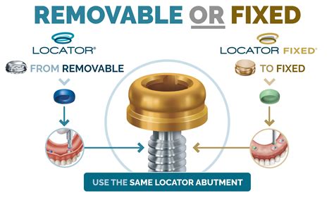 metal housing implant|locator implant attachments.